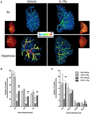 Interleukin-1 Receptor Antagonist Protects Newborn Mice Against Pulmonary Hypertension